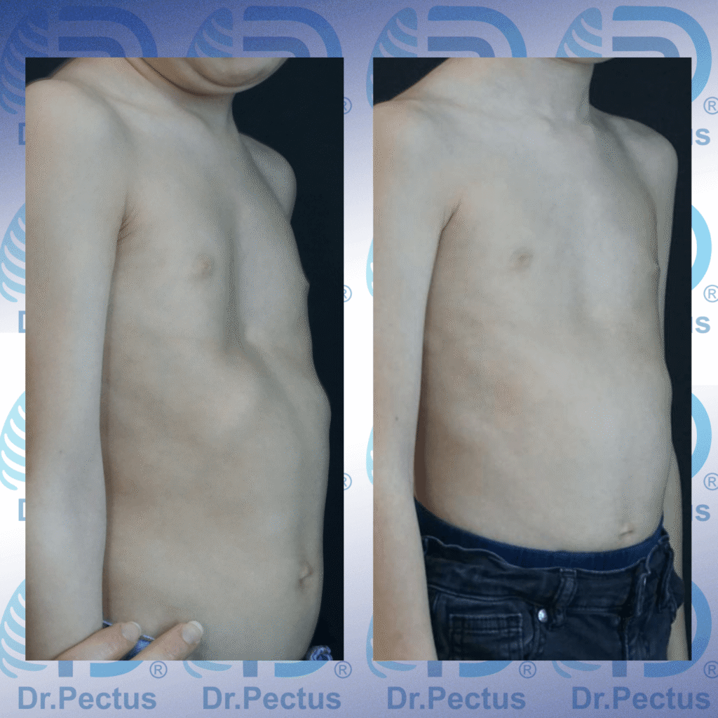 IMG_4196 svg+xml;charset=utf