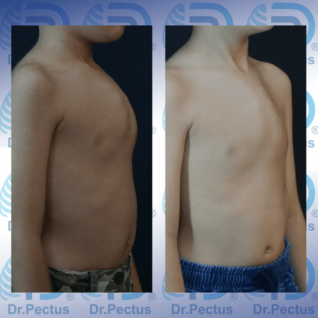 IMG_4197 svg+xml;charset=utf