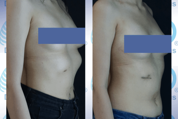 IMG_4208 (1) IMG_4208 (1)